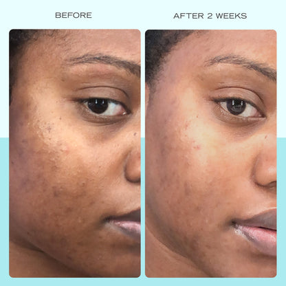 Skinnlif Brightening Serum