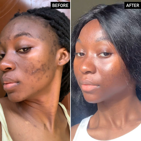 Skinnlif Brightening Serum