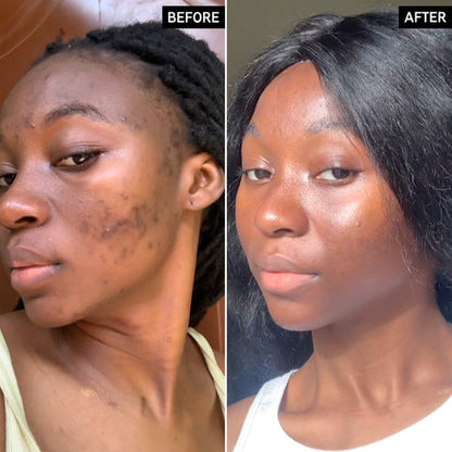 Skinnlif Brightening Serum